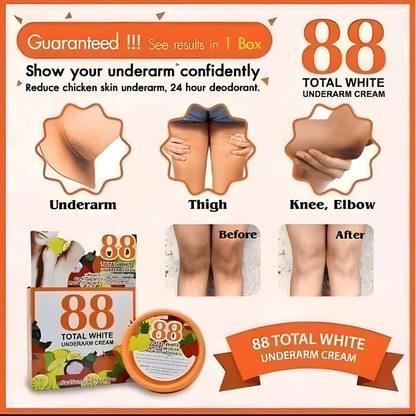 88 Total White Underarm Cream (35g)