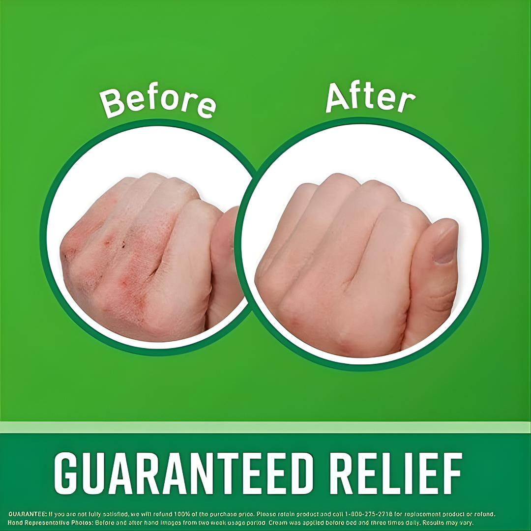 O’Keeffe’s Working Hands Cream (76g)