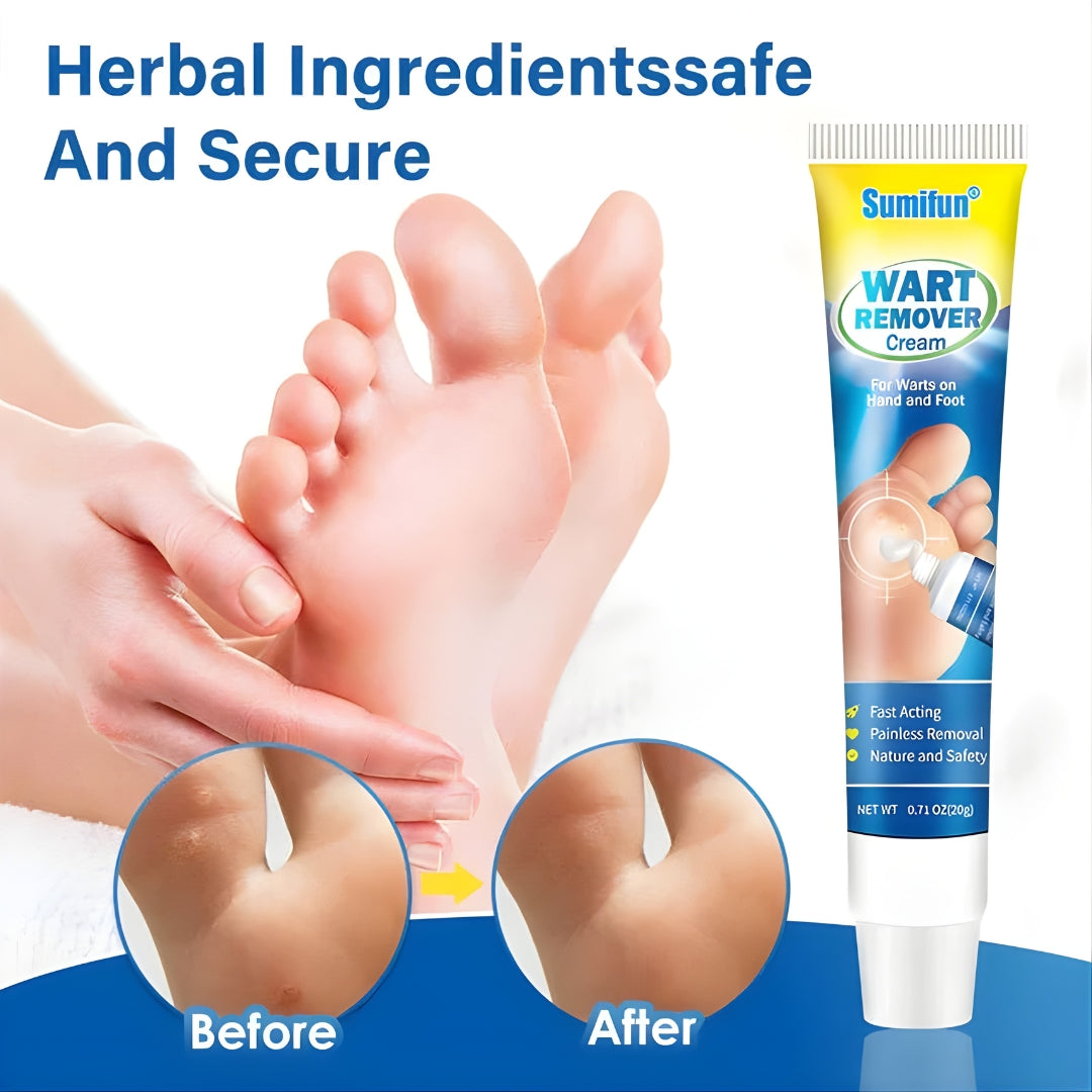 Sumifun Wart Remover Cream 20g