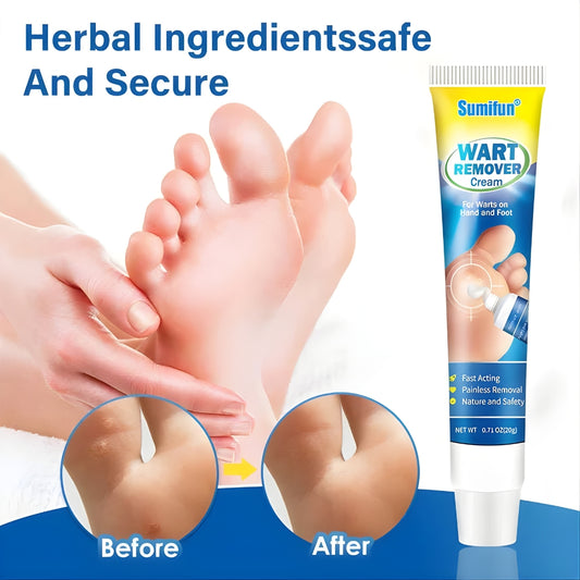 Sumifun Wart Remover Cream 20g