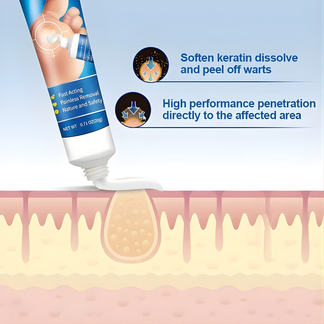 Sumifun Wart Remover Cream 20g