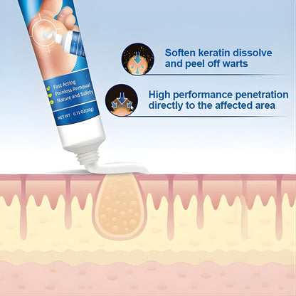Sumifun Wart Remover Cream 20g