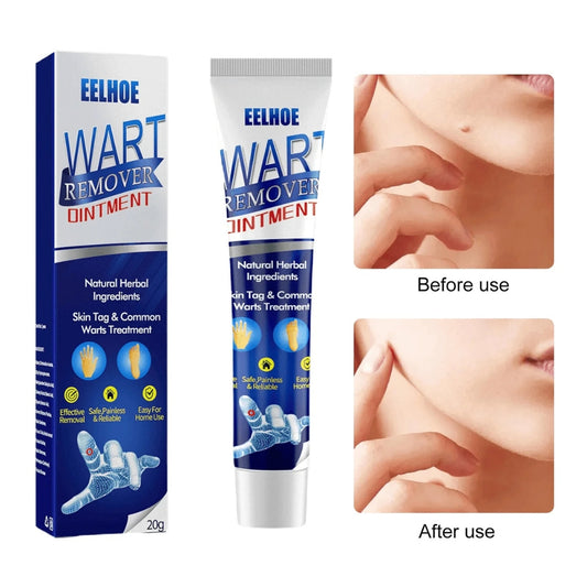 EELHOE Wart Remover Ointment Fast Acting Skin Tag & Wart Treatment (20g)
