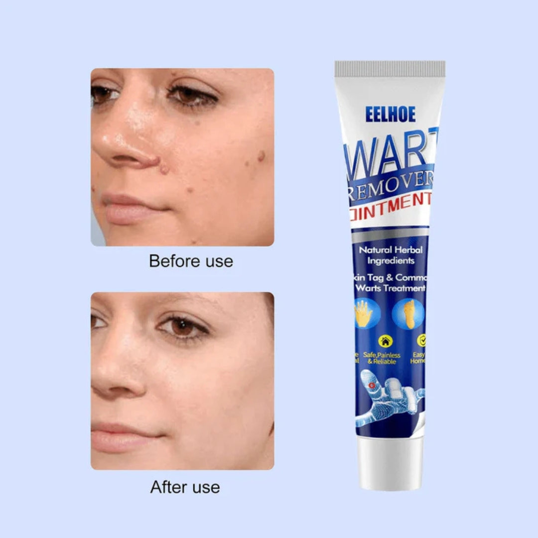 EELHOE Wart Remover Ointment Fast Acting Skin Tag & Wart Treatment (20g)