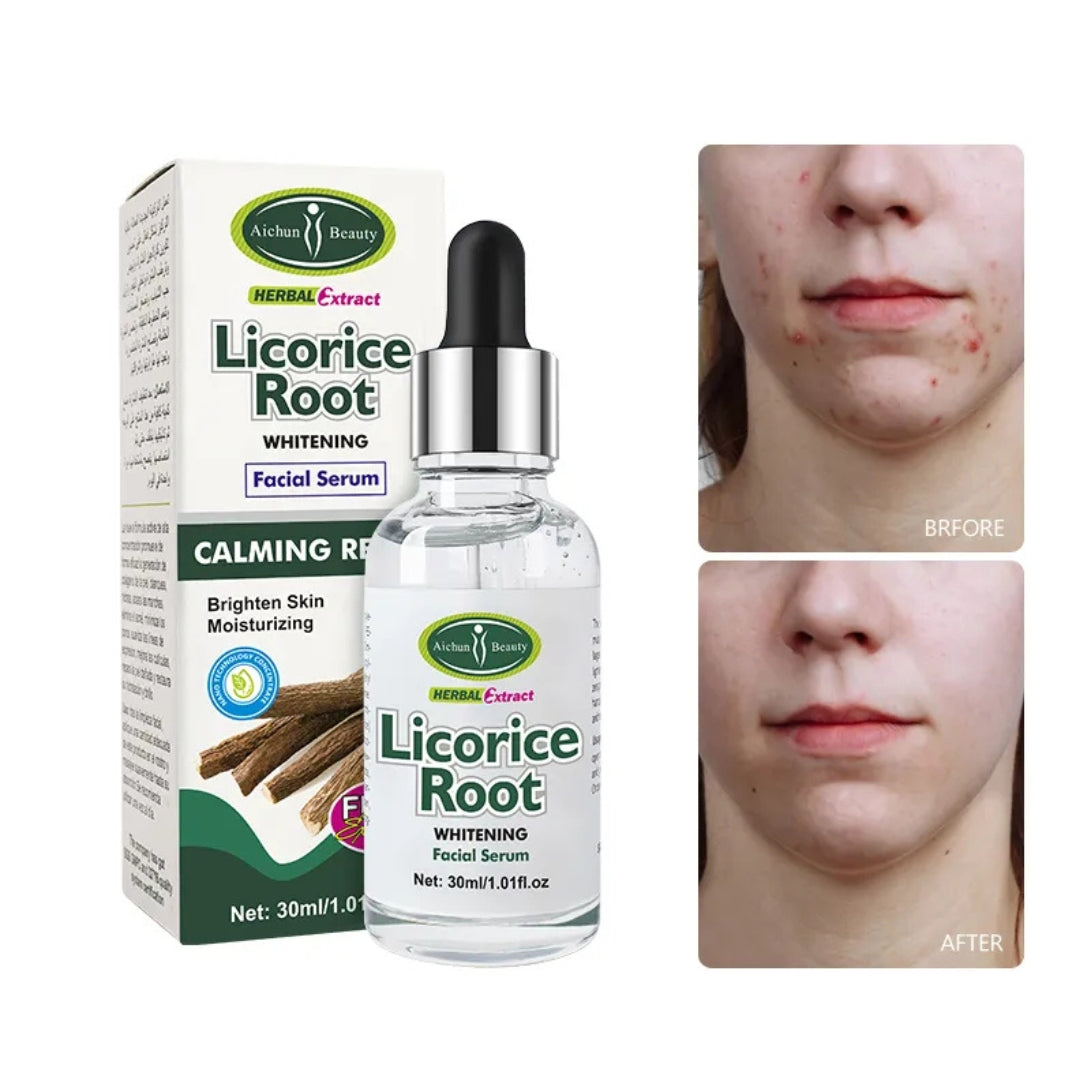 Aichun Licorice Root Anti-Inflammatory Facial Serum 30ml