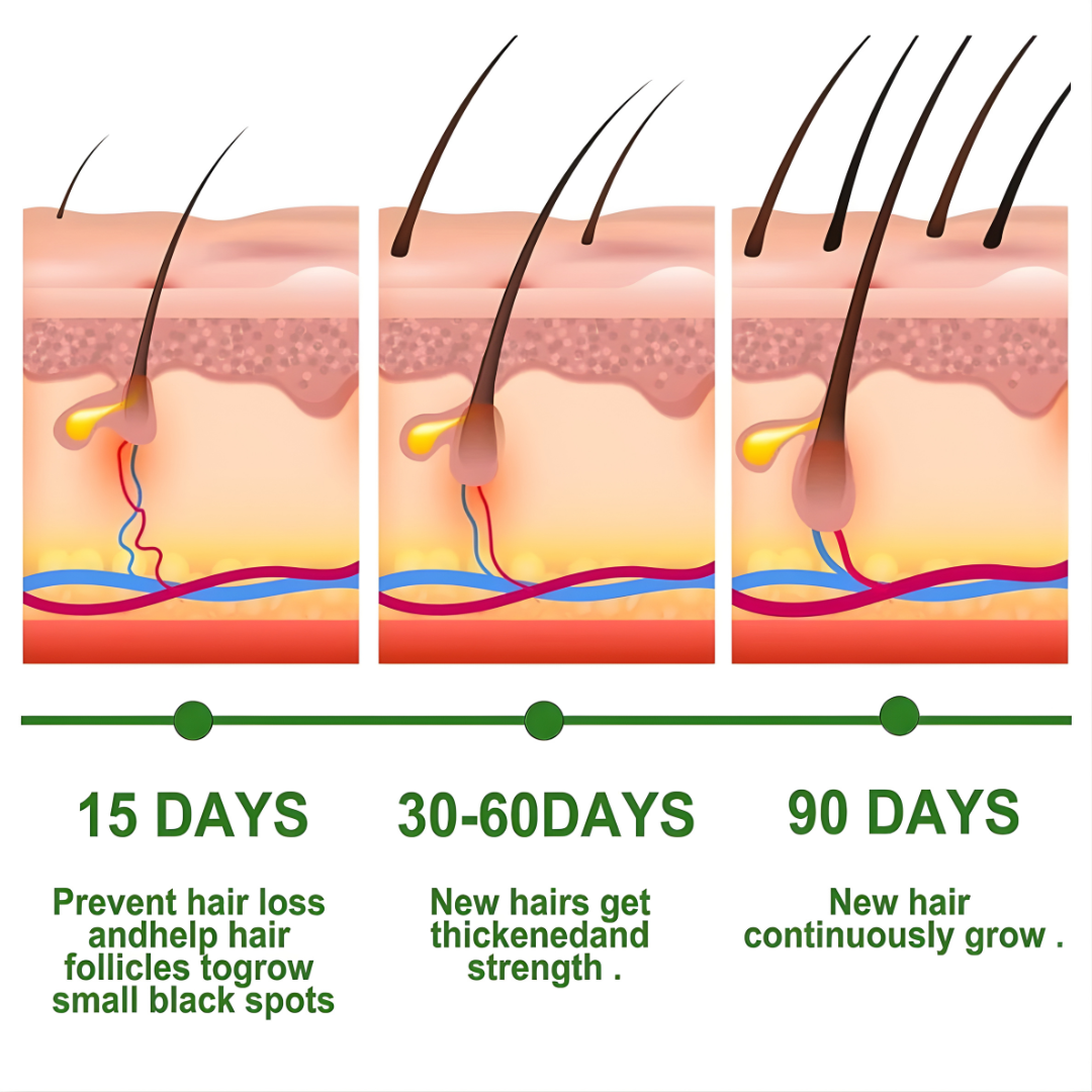 EELHOE Rosemary Oil for Hair Growth