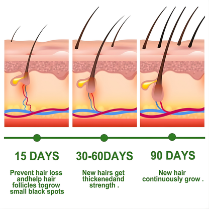 EELHOE Rosemary Oil for Hair Growth