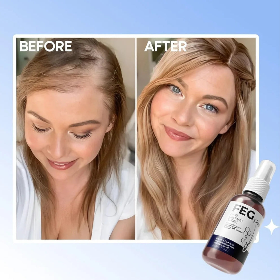 FEG Plus Hair Growth Spray for Hair Loss Control – 50ml